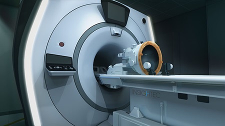 Essential Tremor MRgFUS 